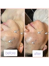 プチュリア(puCuria)/ゾンビパック