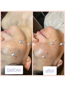 プチュリア(puCuria)/ゾンビパック