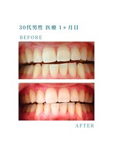 ミノリ(MINORI)/驚きの変化！