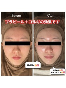 チョアチョア 札幌すすきの店(CHOA-CHOA)/コルギとプラピールが一番人気☆