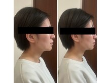 セルビューティー(Cell Beauty)の雰囲気（小顔もお任せ！お顔の筋膜リリース☆ほほ肉、二重アゴスッキリ◎）