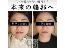 キュープ 鹿児島伊集院店(Qpu)/