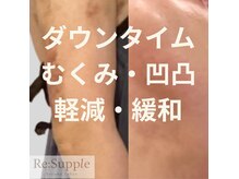 リサプリ(Re: Supple)の雰囲気(ダウンタイムのむくみ・凹凸・つっぱり・軽減・緩和・回復力UP!)