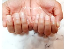 シュポルテ(chou porte)/カラグラ