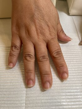 ネイルサロンアンドスクール シーグリーン(SEAGREEN)/【お悩み】爪の形コンプレックス