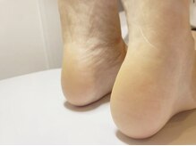 ハイルング(HEILUNG)/足裏角質ケア