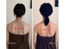 アナパナパ(anapanapa)/バストケア