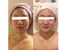 ヴィクトワール(Victoire)/●エラハリ肩こりでお悩みの方●