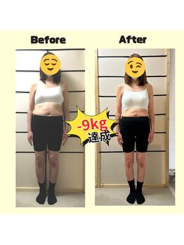きぼう鍼灸整骨院/ダイエット整体3ヶ月プログラム