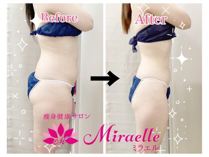 ミラエル(Miraelle)の写真