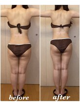 アンフィニ(infini)/短期集中10回コース（3か月)