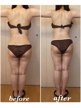 アンフィニ(infini)/短期集中10回コース(3か月)