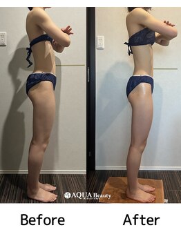 ビーエスアクアビューティー/