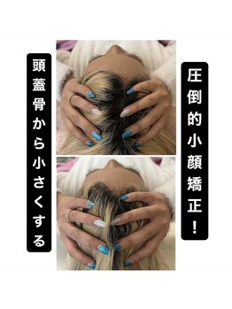 カナエル(CANAEL)/頭蓋骨から小さくする小顔術