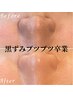 【黒ずみ・ブツブツ毛穴】卒業♪つるんとなめらかなすっぴん素肌へ♪