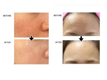 シンシア(sincere)