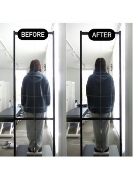 イトウ カイロプラクティックパートナー(ITOU)/お客様のBefore &After