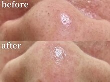 ラティエル(Latiele)/お肌に優しい無添加毛穴ケア