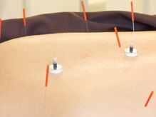 ジョンファ目黒鍼灸院/もみほぐし鍼灸75分