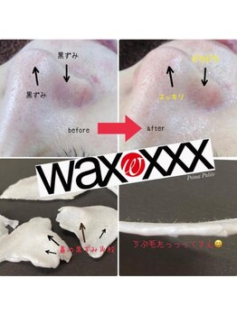 プリマプリート 各務原店/毛穴詰まり角栓埋もれ毛スッキリ