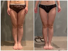 ツーアップ(2up)/内もも隙間、ふくらはぎスッキリ