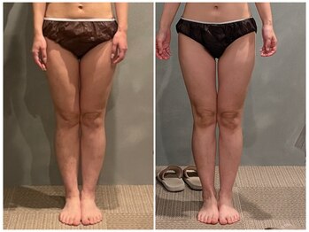 ツーアップ(2up)/内もも隙間、ふくらはぎスッキリ