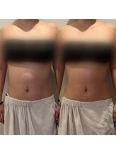 ウィール 栄 矢場町店(WE:LL)/ウエスト集中