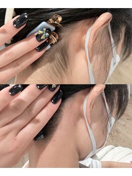 シュガーリングハウスレディ(SugaringHouse LADY)/うなじ