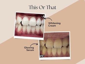 ホワイト つくば店(WHITE)/【26トーンup】22照射後のお客様