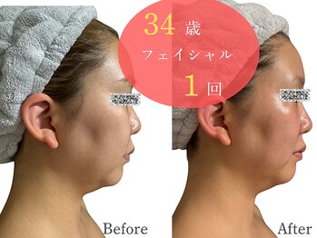 アルピナ(ALPINA)/ウルトランスフォーマー