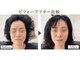 リラボ整体院 赤坂店(RE+LAB=◯整体院)の写真/日本1受賞の独自の小顔矯正。小顔になりたい、歪みを改善させたい/麻布/麻布十番/赤阪/赤阪見附/整体/小顔
