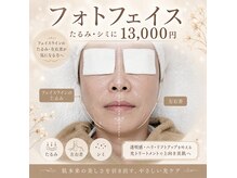 リラ クア 相武台サロン(Rela Qua)の雰囲気（光フォトでフェイスラインをスッキリ）