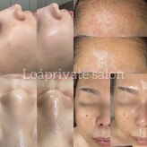 Loa private salon
