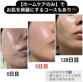 エーケーエステティックス 熊本新市街店(AK Esthetics)