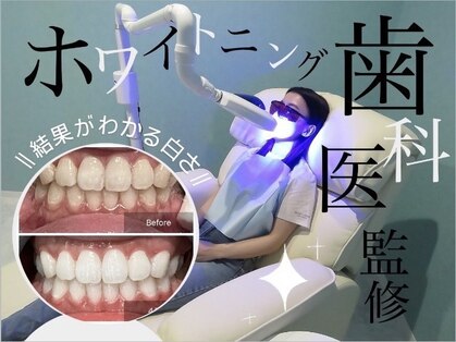 エックス(X)の写真