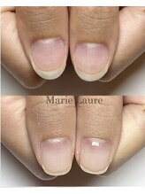 マリーロール 天王寺店(Marie Laure)/自爪育成/深爪矯正/ネイルケア