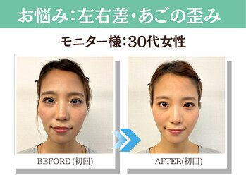 ナチュラルパーフェクトフェイス 新宿/ビフォーアフター写真