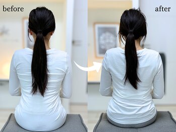 エーアール(AR)/【Before/After】