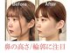 隆鼻矯正専門店 ラプリセレネ (Raplit Selene)の写真/“顔の中心×輪郭”を同時に整える新常識!!隆鼻矯正×小顔矯正で叶える立体的で洗練された印象へ。