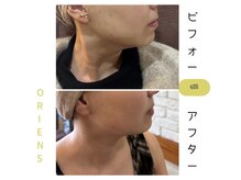 オリエンス(oriens)の雰囲気（頭皮も肌質も首も！サロンでエクソソーム100%トリプルショット☆）