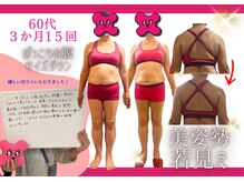 骨盤ちゃん 上越モール店/60歳でもちゃんと変わる！！
