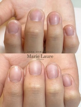 マリーロール 梅田店(Marie Laure)/自爪育成/深爪矯正/ネイルケア