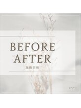 ピピ 三軒茶屋(pipi)/BEFORE　AFTER