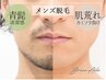 【メンズ脱毛★清潔ヒゲ脱毛】鼻下＆両ほほ＆アゴ＆アゴ下首の広範囲