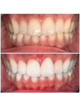 ライトビューティー 池袋店(LightBeauty)/症例写真