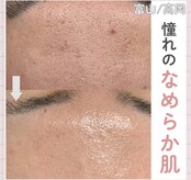 サロン リュンヌ(salon lune)