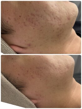 ル シェリア(Le Cherien)/スピーカーズ100万本入れ込み