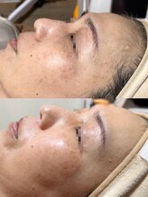 モアナ(Moana)/【広島初最新光フォト導入】