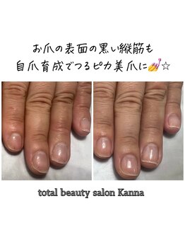 カンナ(Kanna)/5500円