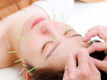 楓の杜鍼灸院の写真/【女性専用隠れ家鍼灸院】"なんとなく不調"の原因、お伝えします。本来の健康をお届け。鍼灸デビューにも◎